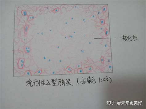 组织切片手绘图