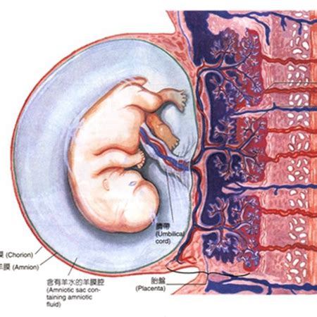 孕期怎样防止胎儿长胎记