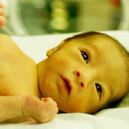 什么是新生儿病理性黄疸?