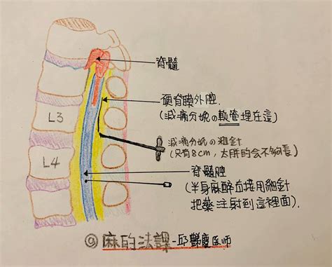 影响分娩疼痛的因素