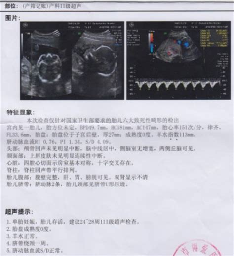 怀孕后b超单怎么看孕周