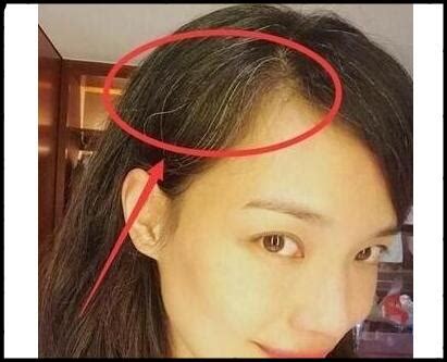 为什么人年纪变大了会发腮