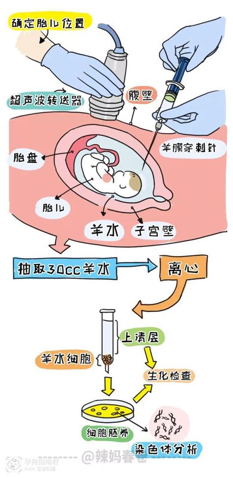 假装怀孕流血羊水破了