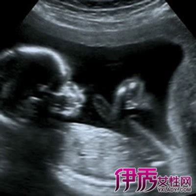 孕晚期怎么判断胎儿位置