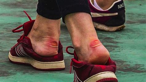 鞋子磨腳怎么辦