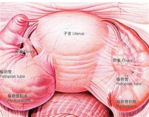 卵泡黄素化什么意思?