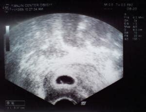 孕16周胎心155左右