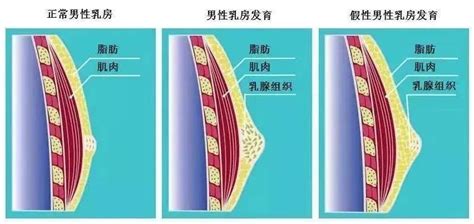 一侧乳房突然有硬块还隐隐作痛