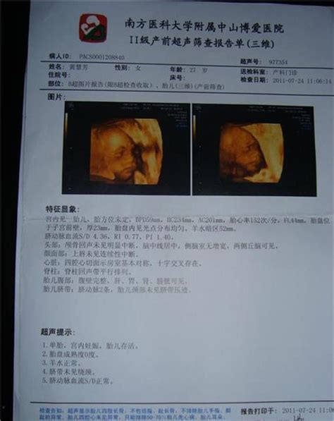 b超单显示怀孕6周实际怀孕多久