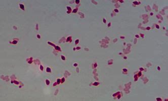 短双歧杆菌和罗伊氏乳杆菌的区别
