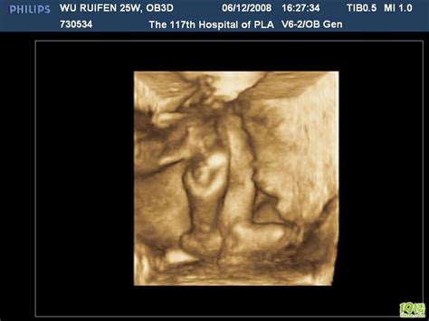 13周的胎儿b超图片
