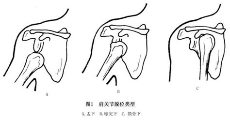 肱骨是胎儿的哪个部位