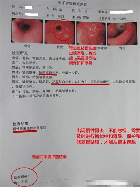 慢性盆腔炎的症状表现有哪些呢