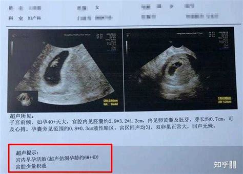 怀孕8周b超图片