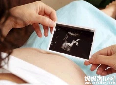 孕早期胎停有什么症状
