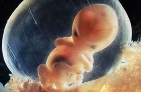 胚胎不着床是什么原因