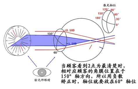 散光100度相当于近视多少度
