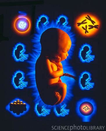 胎儿特纳综合征是谁的原因