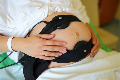 孕晚期测胎心胎儿缺氧