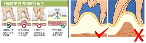 反复使用胰岛素针头有哪些危害