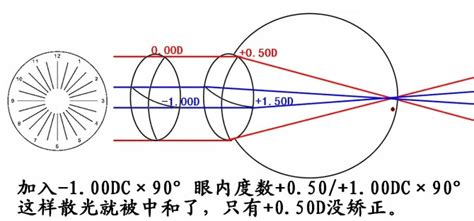 散光