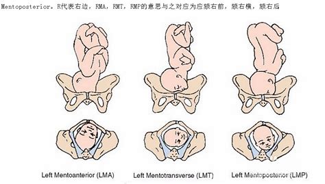 胎位loa与lop的区别