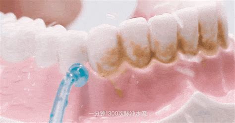 全口假牙有什么胶可粘在牙床上