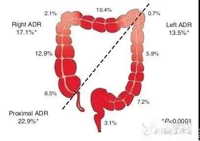 肠息肉有什么症状