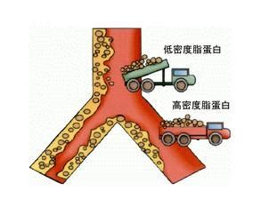 低密度脂蛋白胆固醇偏高吃什么好