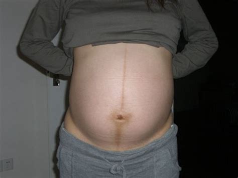 怀孕6周图片