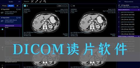 哪里可以下载到.dic格式的东西