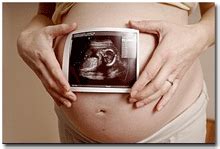 孕期多次做b超对胎儿有影响吗