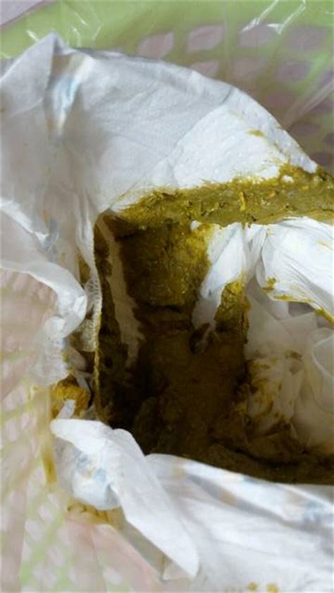婴儿换了奶粉不拉便便