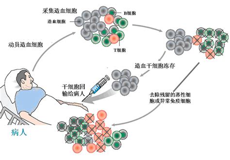 舒张早期血流反向怎么治