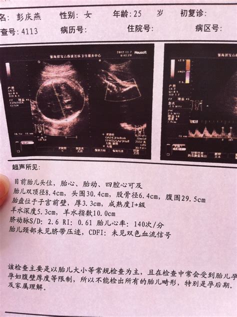 股骨长每周长多少正常