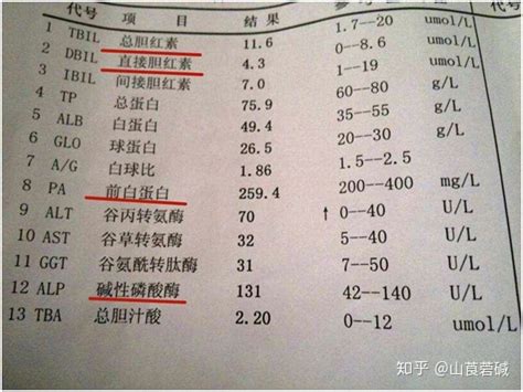 空腹血糖检查前的注意事项