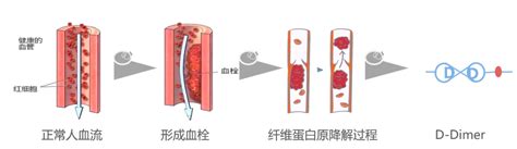 孕妇d2聚体多高有危险