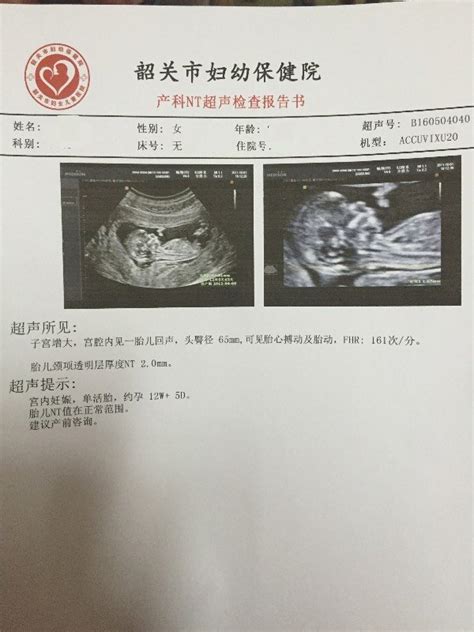 孕16周胎心率150