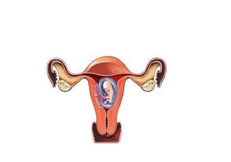 左侧残角子宫是什么意思