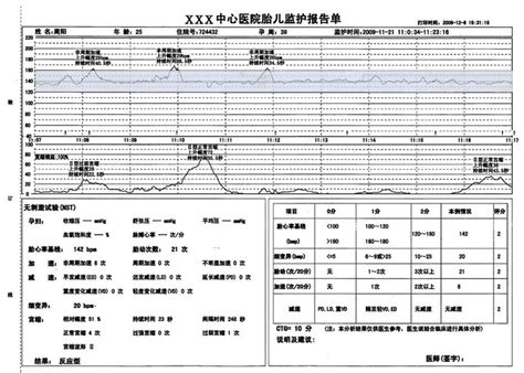 32周胎心监护多少算合格
