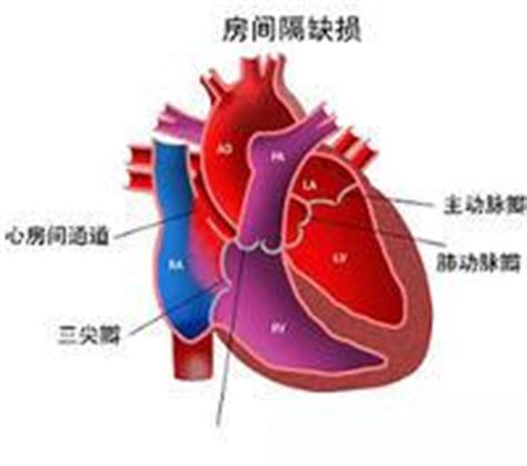 9岁男孩儿心脏多处畸形