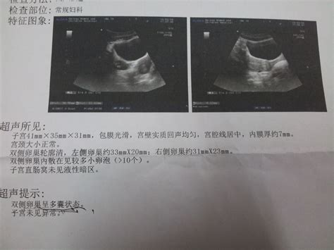 怀孕两次胎停医生建议试管