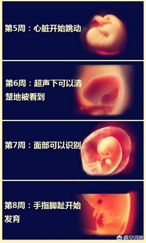 胎儿快出生有什么症状