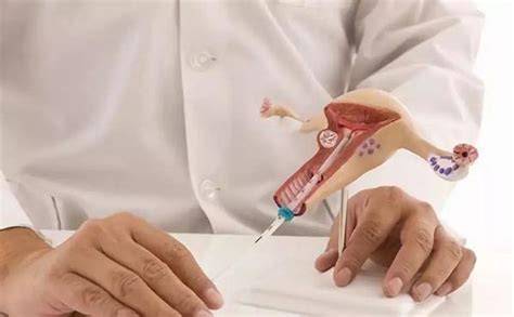 宫腔镜检查手术后注意事项