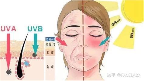 红蓝光对皮肤有哪些伤害