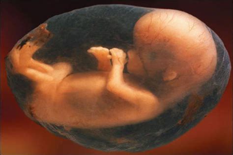 酒后怀孕对胎儿有什么影响