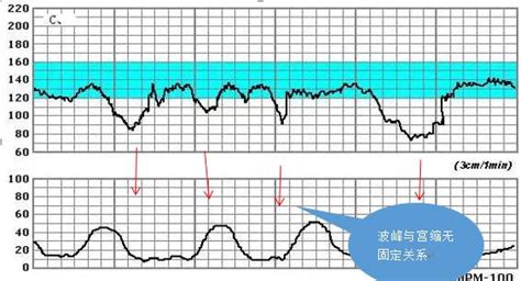 孕晚期的胎心160左右正常吗