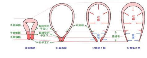 后位子宫怎么矫正