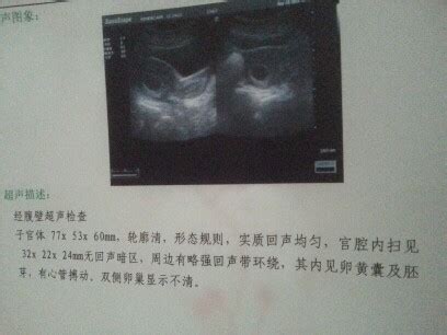 怀孕后胎停的表现