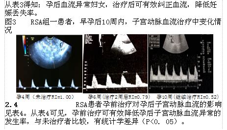 生化妊娠只流了一天血块